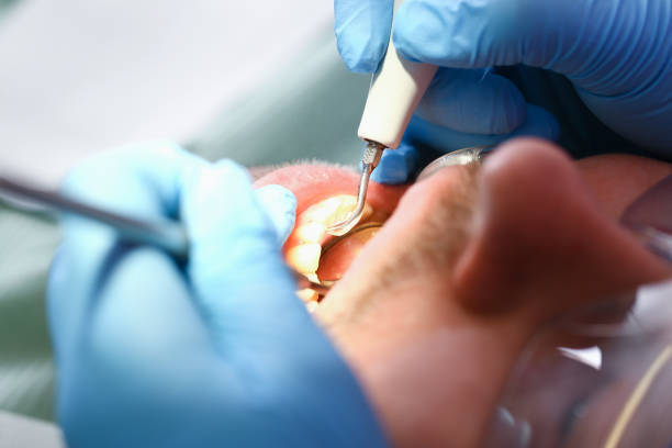 Best Urgent Dental Care for Toothache in Wintersville, OH