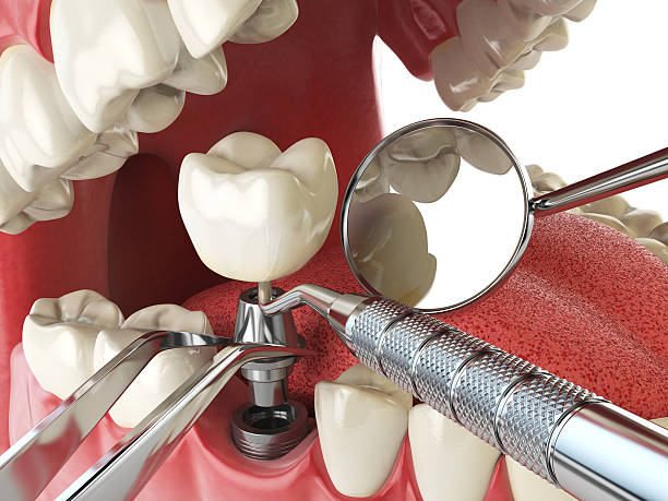 Best Broken or Cracked Tooth Emergency Dentist in Wintersville, OH